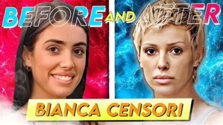 Bianca Censori Cosmetic Surgery: Journey, Transformation, and Insights