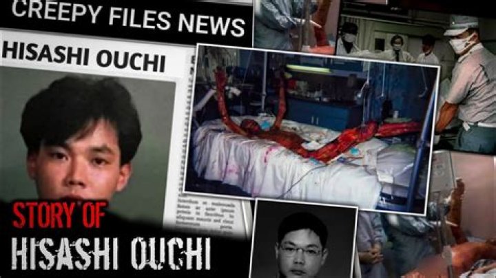 What Happened to Hisashi Ouchi: A Comprehensive Analysis of a Tragic Event